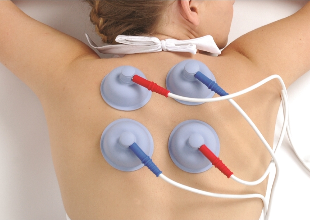 Electrical Muscle Stimulation, Electrical Stimulation Therapy, Newark NJ